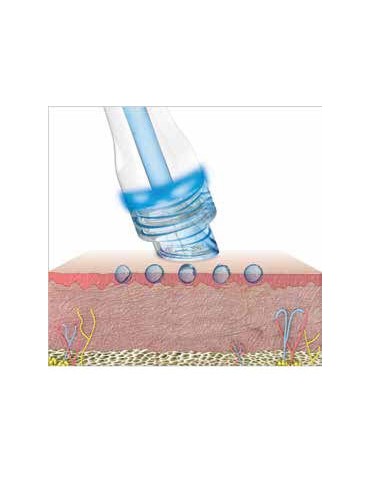 Cluederm AQUAPURE intelligent ansigtsbehandlingssystem Æstetisk udstyr Classys AQUAPURE