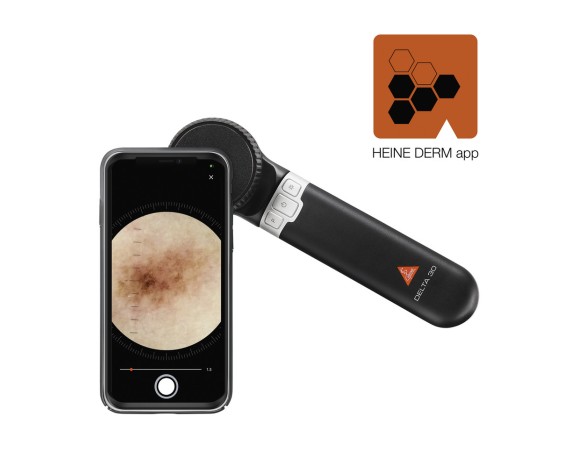 Heine Delta 30 Dermatoscope Heine Dermatoscopes HEINE K-230.28.305