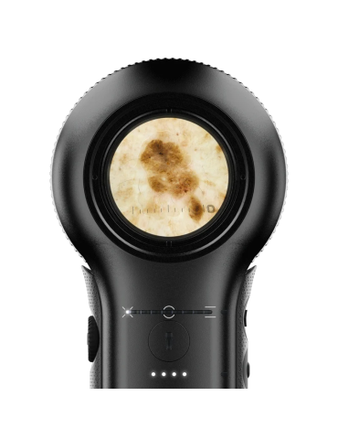 Dermlite DL5 polariseret lys dermatoskop Dermlite Dermatoskoper Dermlite DL5