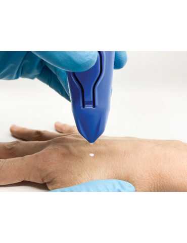 CRYOMEGA CRYOSURGERY DEVICE...