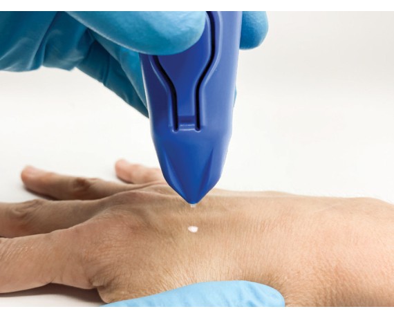 CRYOMEGA KRYOKIRURGIAPPARAT med 16 g patron Kryokirurgi og kryoterapi Gima 30586