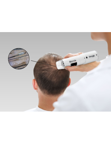 Dino Lite Trichoscope Wireless Digital Trichoscope Wireless Medical Microscopes DinoLite MEDLW4HM