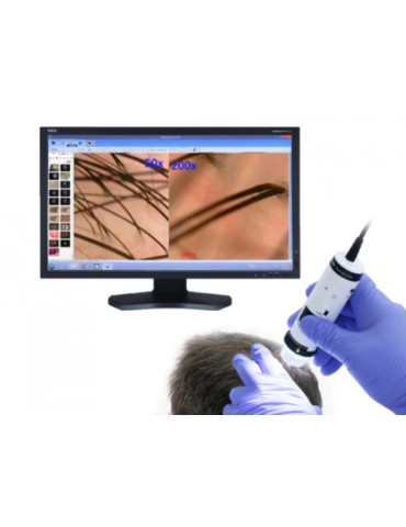 Dino Lite Trichoscope Wireless Digital Trichoscope Wireless Medical Microscopes DinoLite MEDLW4HM