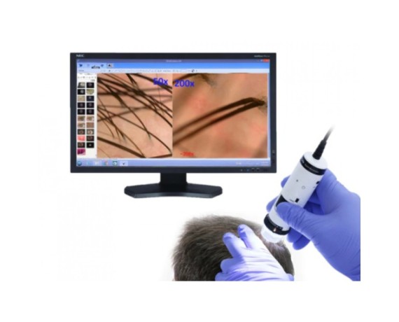 Dino Lite Trichoscope Wireless Digital Trichoscope Wireless Medical Microscopes DinoLite MEDLW4HM