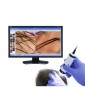 Dino Lite Trichoscope Wireless Digital Trichoscope Wireless Medical Microscopes DinoLite MEDLW4HM