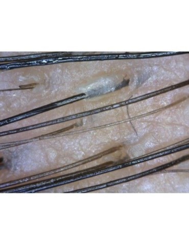 Dinolite Trikoskop BASIC...