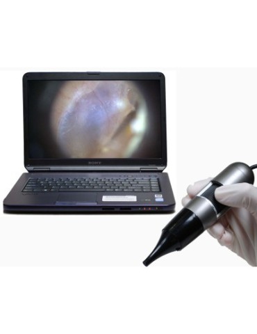 Video Otoscopio Dino Lite Earscope PROOtoscopi DinoLite MEDL4E