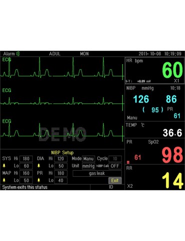 PC-3000 højopløsnings 5-kanals multiparametermonitor Monitor Multiparametrici Gima 35134