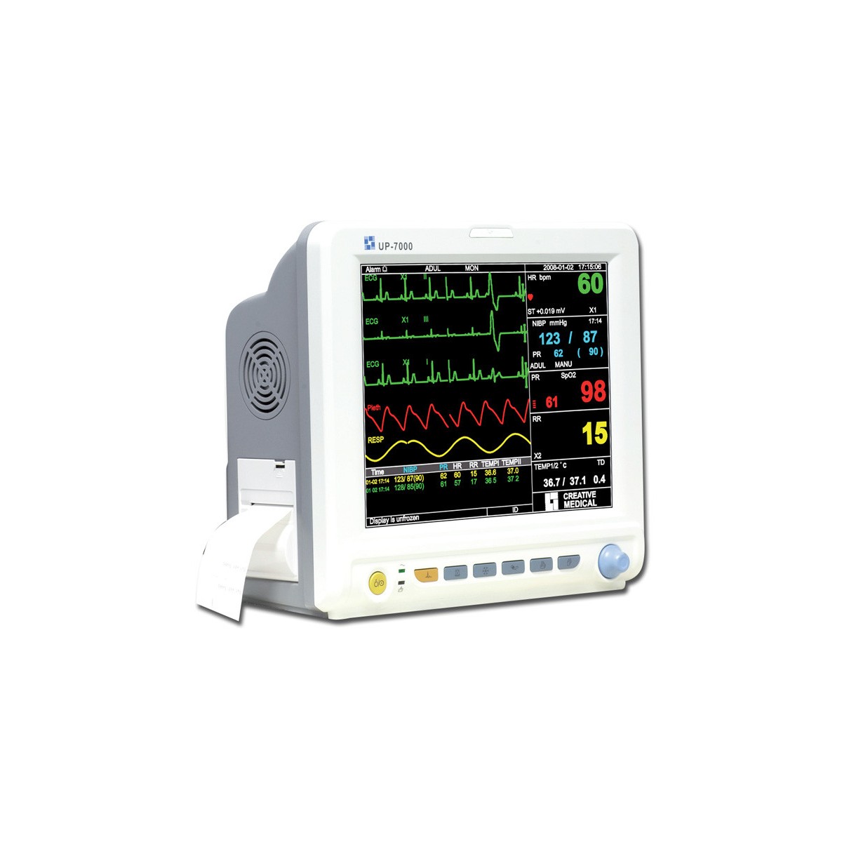 UP 7000 Multiparametrijski monitor s termalnim pisačem Multiparametrijski monitor Gima 35145