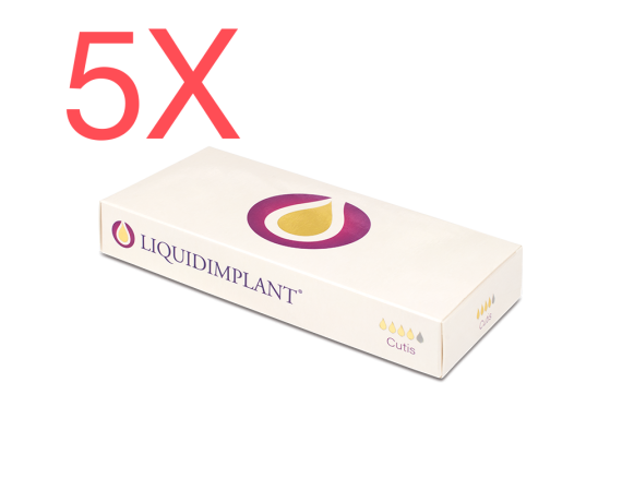 5 stk - LIQUIDIMPLANT Cutis rynke- og læbefiller 5x1ml LIQUIDIMPLANT dermal fillers Novacutis CUTIS-PACK5