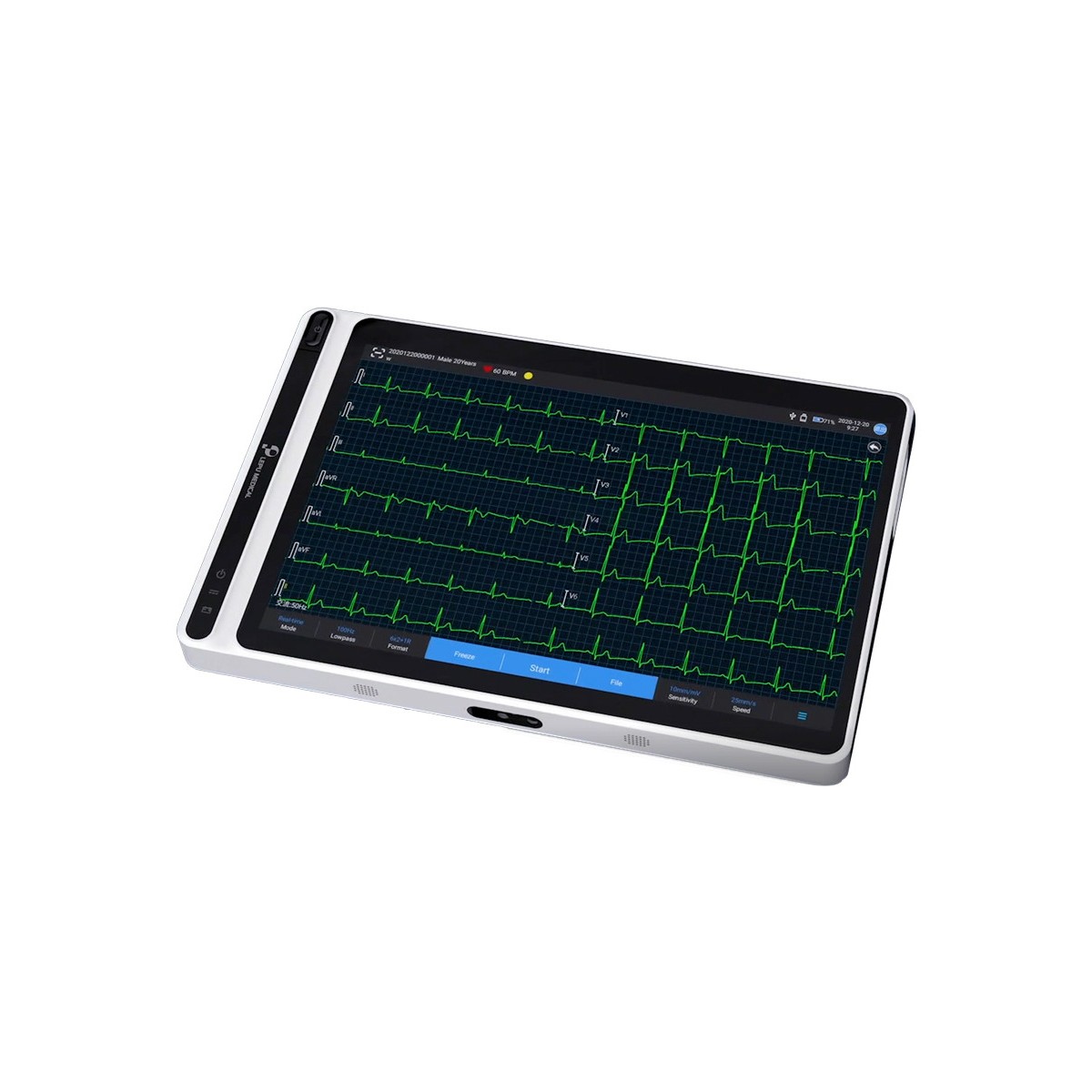 Tablet EKG NEO S120 z ekranem dotykowym Elektrokardiografy 3 - 6 - 12-kanałowe Gima 54230