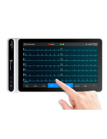 Tablet ECG NEO S120 com tela sensível ao toque Eletrocardiógrafos de 3 - 6 - 12 canais Gima 54230