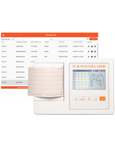 ECG Cardioline 100L FULL - Glasgow e EasyApp com tela colorida sensível ao toque Eletrocardiógrafos de 3 - 6 - 12 canais Gima...