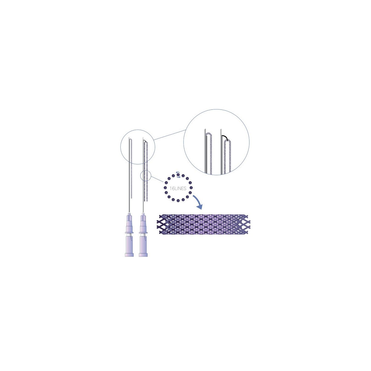 Fire de tracțiune PDO cu șosetă tubulară Retense 19G 38mm cu canulă de tip L Fire de tracțiune cu șosetă tubulară Hyundae Med...