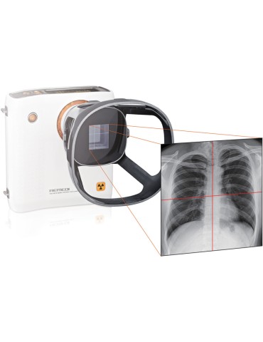 REMEX KA6 RØNTGENSÆT: kamera (32000) + detektor 43x43cm + bærbar computer med software Røntgenkamera og tilbehør Gima 32002