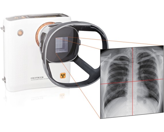 REMEX KA6 RØNTGENSÆT: kamera (32000) + detektor 43x43cm + bærbar computer med software Røntgenkamera og tilbehør Gima 32002