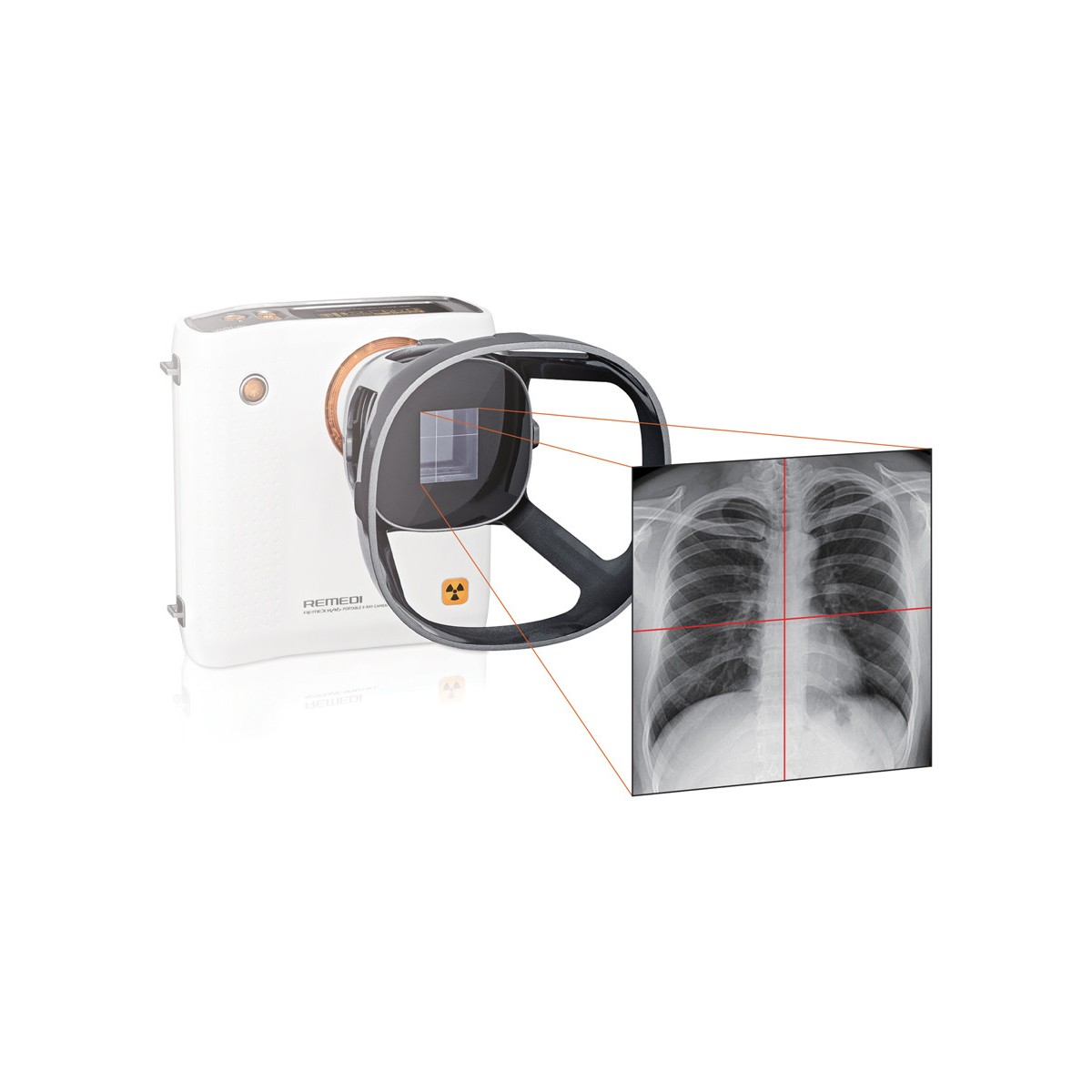 KIT DE RADIOGRAPHIE REMEX KA6 : caméra (32000) + détecteur 43x43cm + ordinateur portable avec logiciel Caméra à rayons X et a...