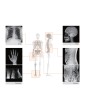 REMEX KA6 X-RAY SET: kamera (32000) + detektor 43x43cm + laptop szoftverrel Röntgenkamera és tartozékok Gima 32002