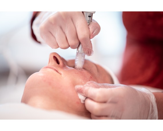 XCellaris PRO TWIST Dispositivo Needling Medicale Originale DermarollerDermaroller Gmbh Dermaroller VK-1100.213.01