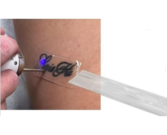 PFD Silicone Tattoo Removal Patch - Disposable patch with perfluorodecalin for laser tattoo removal Anti cellulite and liftin...