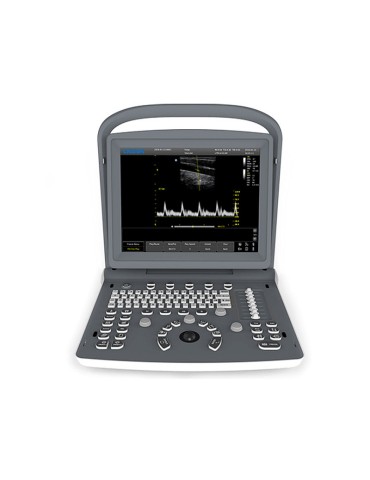 Sistema de ultrassom veterinário portátil Chison ECO-2 VET com 1 conector de sonda Ecografi e Accessori Gima 33945