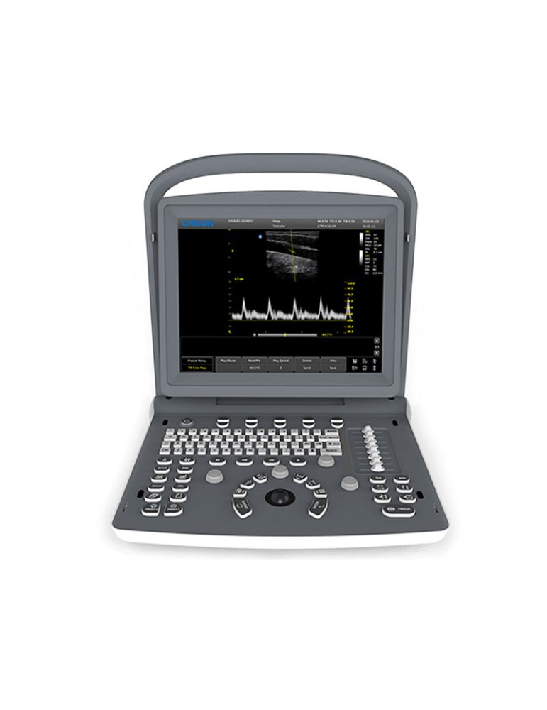 Chison ECO-2 VET Tragbares Veterinär-Ultraschallsystem mit 1 Sondenanschluss Ecografi e Accessori Gima 33945