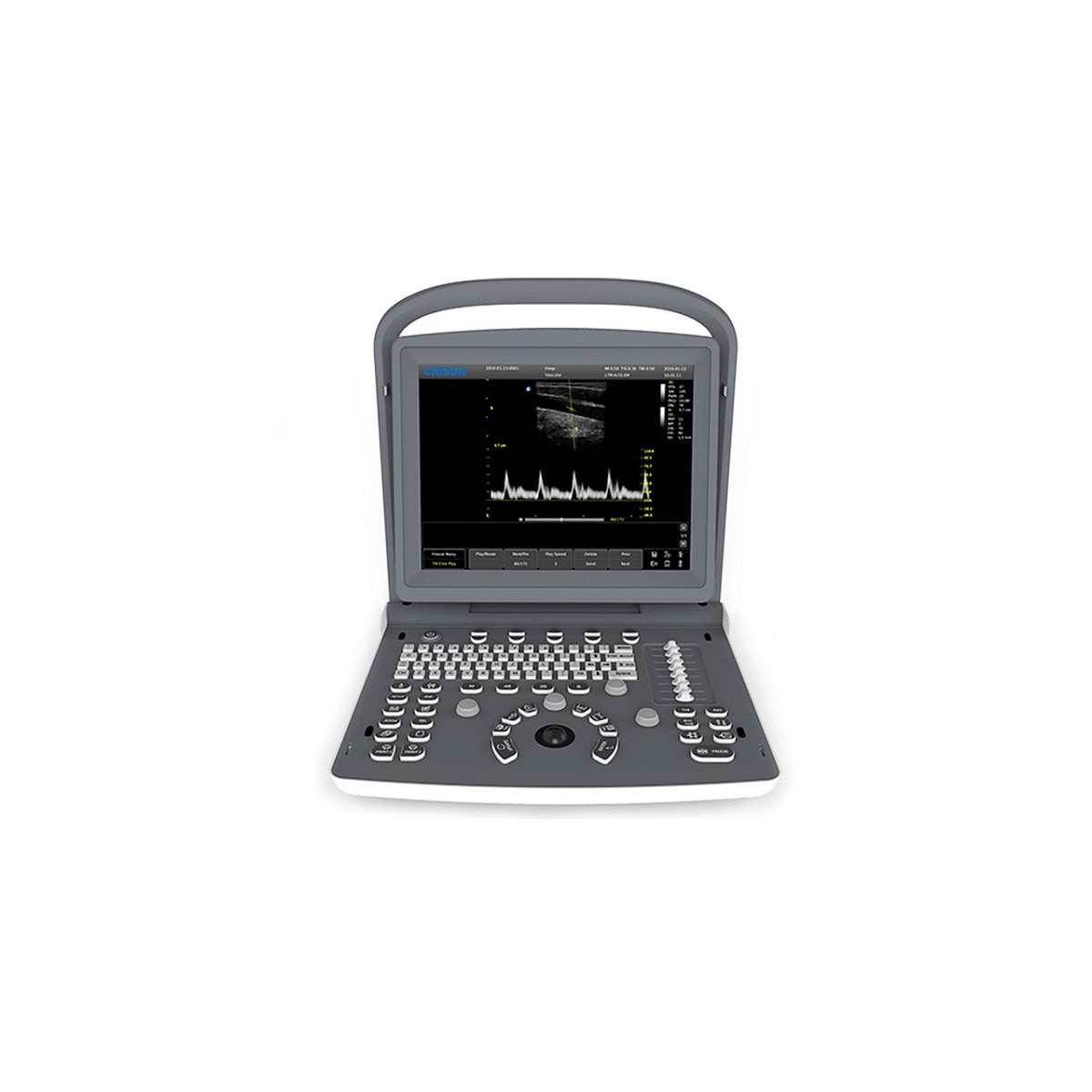 Chison ECO-2 VET Portable Veterinary Ultrasound System with 1 Probe Connector Ultrasound Scanners and Accessories Gima 33945