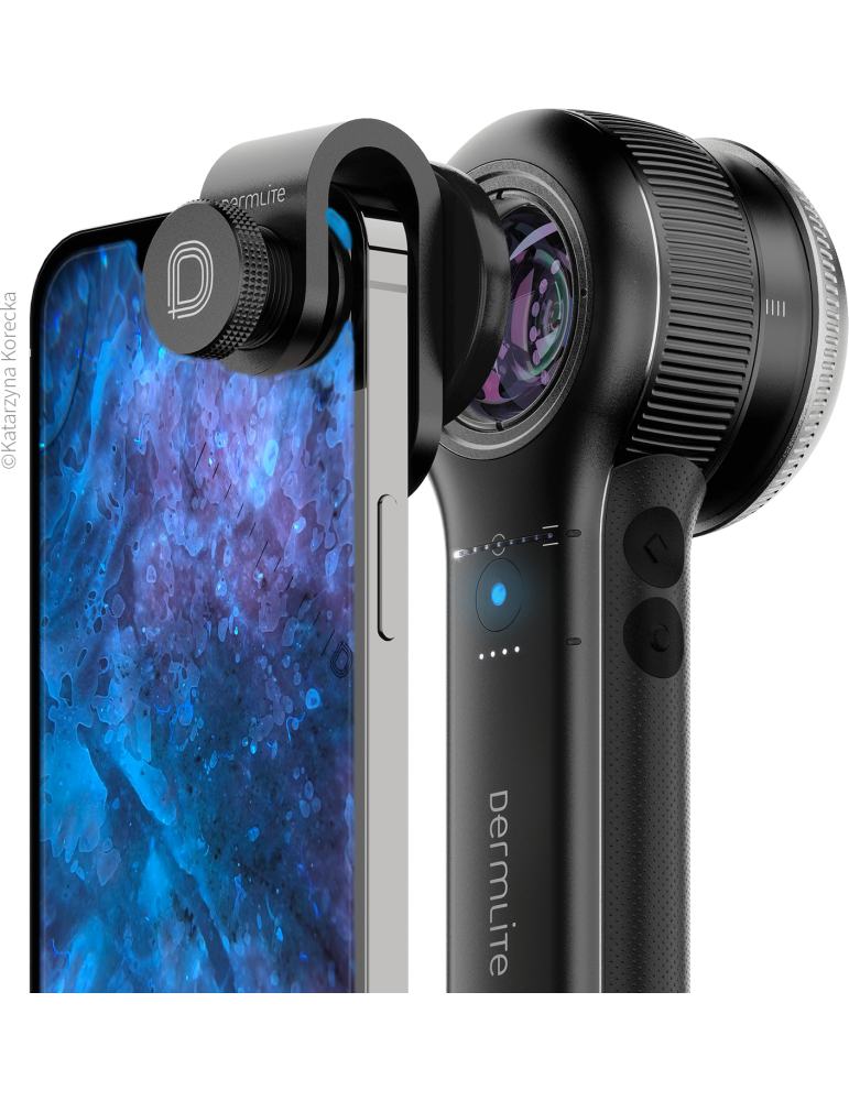 DermLite DL5 Plus Portable Digital Hybrid Dermatoscope Dermlite Dermatoscopes Dermlite DL5 Plus