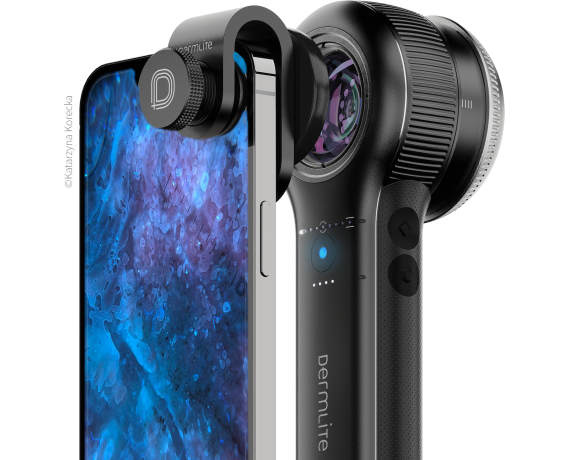 DermLite DL5 Plus hordozható digitális hibrid dermatoszkóp Dermlite dermatoszkópok Dermlite DL5 Plus