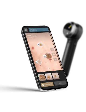 DermLite DL5 Plus bærbart digitalt hybriddermatoskop Dermlite dermatoskoper Dermlite DL5 Plus