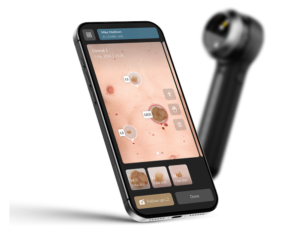 Dermatoscop hibrid digital portabil DermLite DL5 Plus Dermatoscoape Dermlite Dermlite DL5 Plus