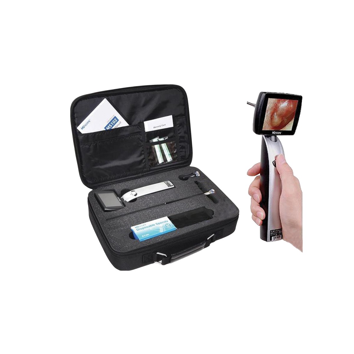 MD Scope MS102 Deluxe -video-otoskooppi, jossa 2 anturia - GIMA Otoskoopit Gima 32170