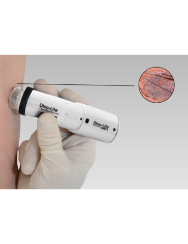 Dino-Lite DermaScope...