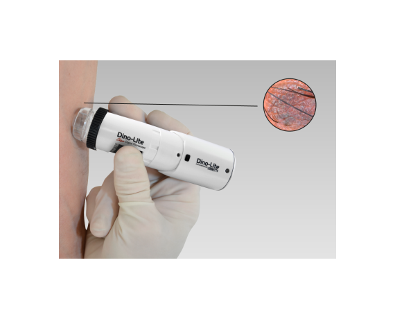 Dino-Lite DermaScope bežični - 1,3 MP Wi-Fi digitalni dermatoskop Bežični medicinski mikroskopi DinoLite MEDLW4DW