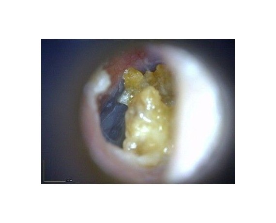 Dino-Lite EarScope Basic Wireless - Otoscopio digital Wi-Fi Microscopios médicos inalámbricos DinoLite MEDLW3E
