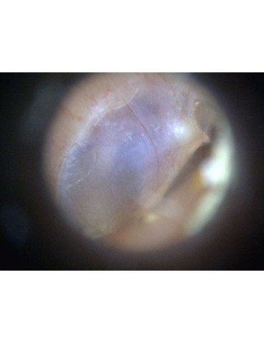 Dino-Lite EarScope Basic Wireless - Otoscopio digital Wi-Fi Microscopios médicos inalámbricos DinoLite MEDLW3E