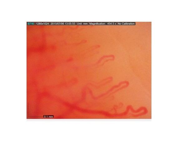 Dino-Lite CapillaryScope 500 Pro Wireless Pro - Capilaroscop digital Wi-Fi 500x Microscoape medicale fără fir DinoLite MEDLW4N5