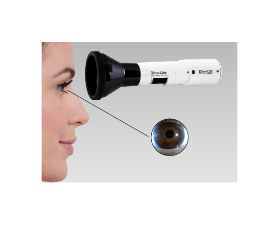 Dino-Lite IriScope Wireless - Iridoscope numérique Wi-Fi 1,3 MP Microscopes médicaux sans fil DinoLite MEDLW4R