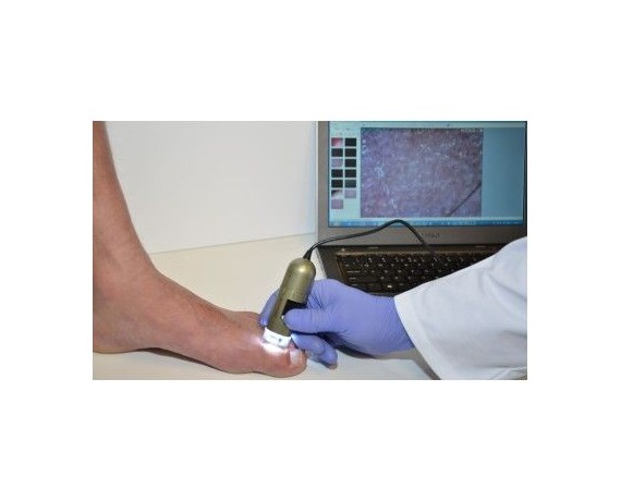 Dino-Lite PodoScope - 1.3MP 10-50x USB Digitalt Podoskop DinoLite MEDL4FW Digitale Mikroskoper