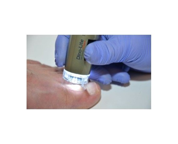 Dino-Lite PodoScope - Podosscópio digital USB 1,3 MP 10-50x Microscópios digitais DinoLite MEDL4FW