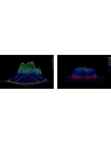 Q-kytkentäinen laser Lutronic SpectraLaser Q-kytkentäinen Lutronic