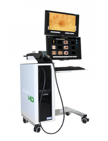 Cyfrowy dermatoskop wideo Molemax HD Dermatoskop Filmy Derma Medical Systems