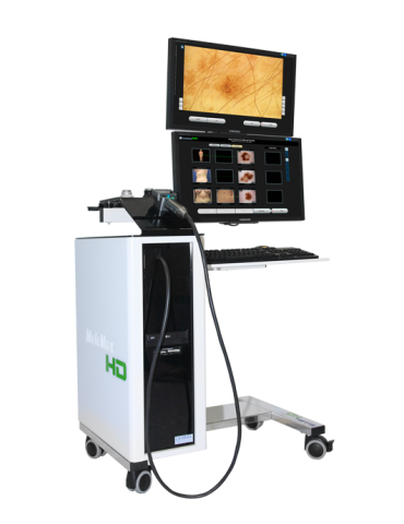 Digitaalinen videodermatoskopia Molemax HD -videodermatoskopia Derma Medical Systems