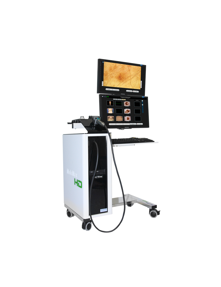Videodermatoscope Molemax HDVideo Dermatoscope Derma Systèmes médicaux Videodermatoscope Molemax HDVideo Dermatoscope Derma Systèmes médicaux