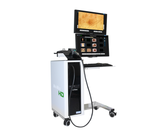 Digitaalinen videodermatoskopia Molemax HD -videodermatoskopia Derma Medical Systems
