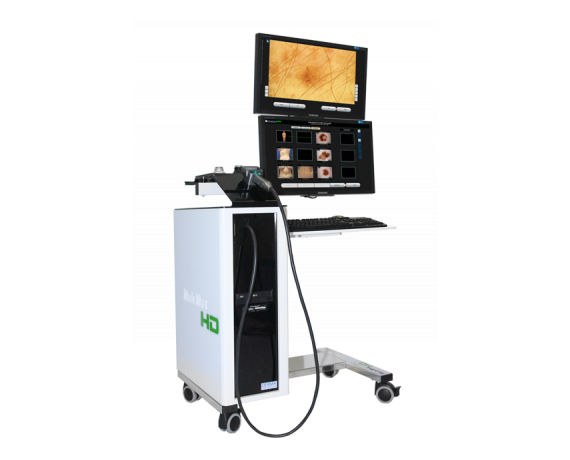 Molemax HD Digitales Videodermatoskop Video-Dermatoskope Derma Medical Systems
