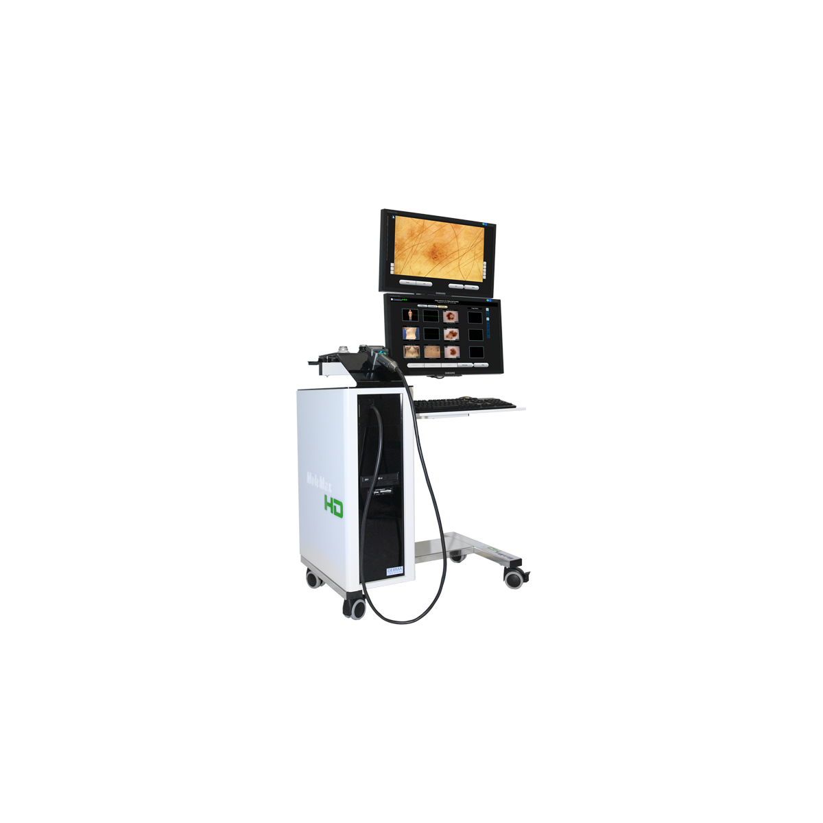 Molemax HDVideo Digitale Videodermatoscoop Dermatoscopen Derma Medische Systemen
