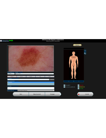 Digitaalinen videodermatoskopia Molemax HD -videodermatoskopia Derma Medical Systems