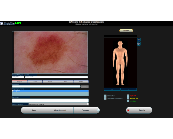 Vidéodermatoscope numérique Molemax HD Dermatoscopes vidéo Derma Medical Systems