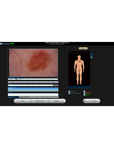 Digitaalinen videodermatoskopia Molemax HD -videodermatoskopia Derma Medical Systems